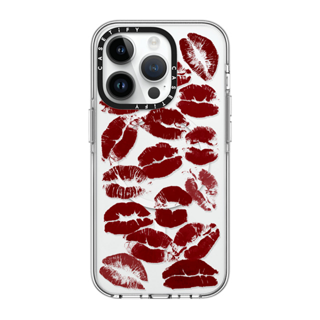 CASETiFY iPhone 14 Pro Case Clear Clear Case MagSafe Compatible Hot Lips casetify_artist CASETiFY iPhone 14 Pro Case Clear Clear Case MagSafe Compatible Hot Lips casetify_artist