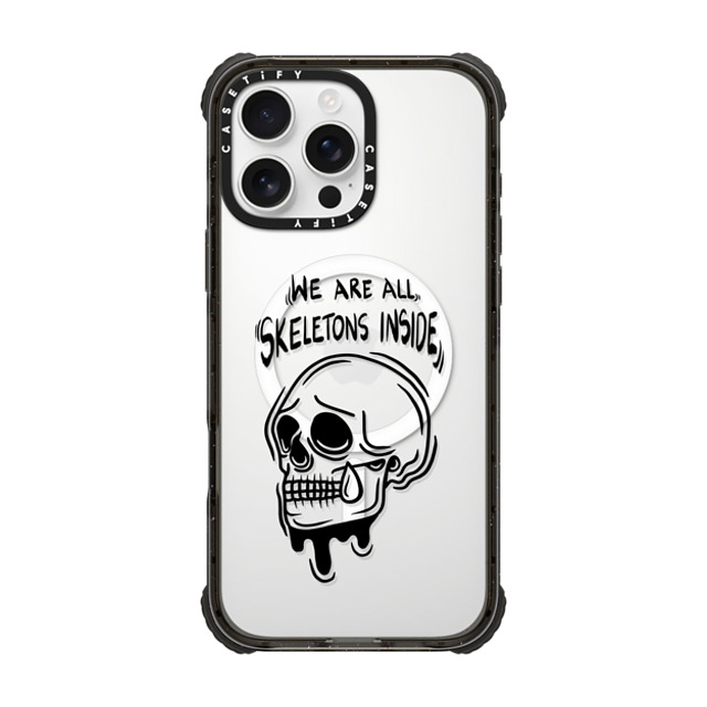 Sadskelly x CASETiFY iPhone 16 Pro Max Case Skull,Monochrome Black ウルトラ インパクトケース MagSafe 対応 Skeletons inside Father's Day Sadskelly x CASETiFY iPhone 16 Pro Max Case Skull,Monochrome Black ウルトラ インパクトケース MagSafe 対応 Skeletons inside Father's Day
