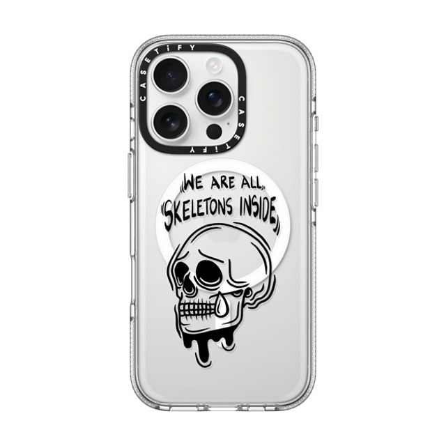 Sadskelly x CASETiFY iPhone 16 Pro Case Skull,Monochrome Clear Clear Case MagSafe Compatible Skeletons inside Father's Day Sadskelly x CASETiFY iPhone 16 Pro Case Skull,Monochrome Clear Clear Case MagSafe Compatible Skeletons inside Father's Day