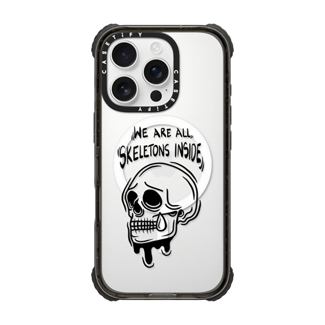 Sadskelly x CASETiFY iPhone 16 Pro Case Skull,Monochrome Black ウルトラ インパクトケース MagSafe 対応 Skeletons inside Father's Day Sadskelly x CASETiFY iPhone 16 Pro Case Skull,Monochrome Black ウルトラ インパクトケース MagSafe 対応 Skeletons inside Father's Day