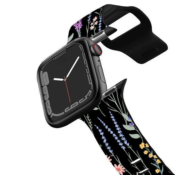 casetify harry potter watch band